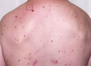 Microscope confoncal